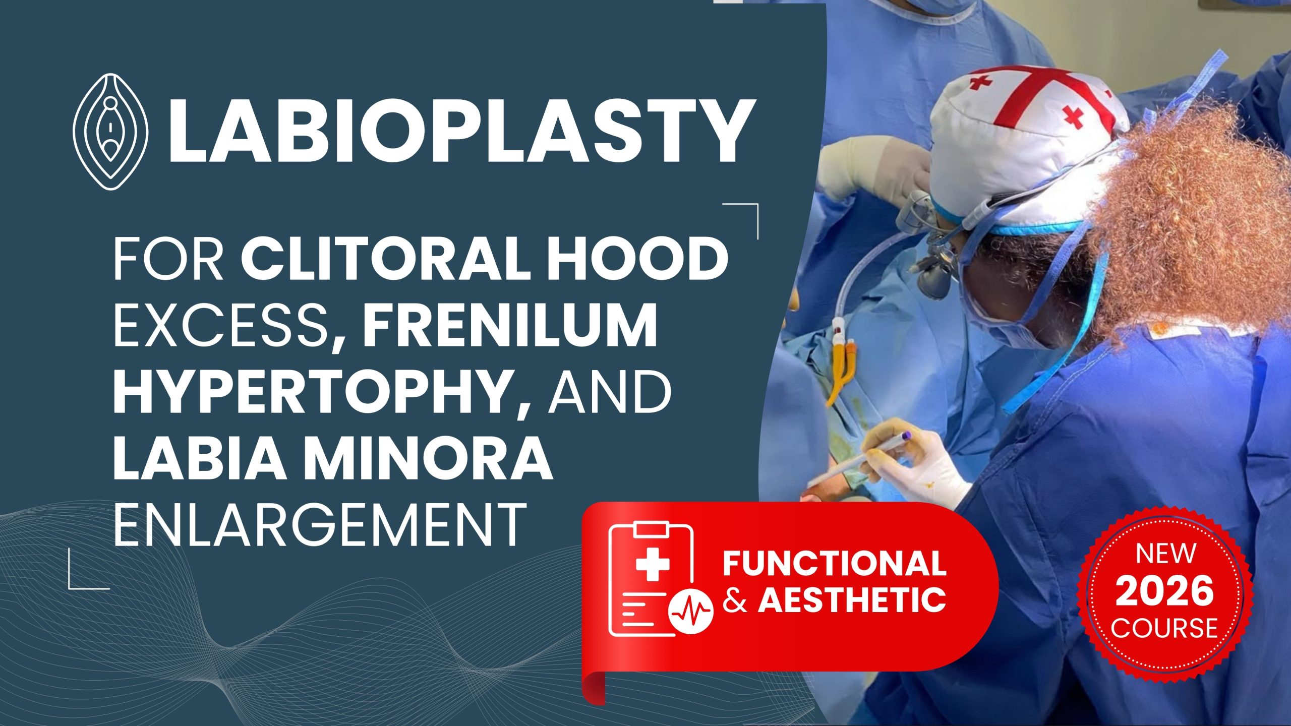 Functional and Aesthetic Labiaplasty for Clitoral Hood Excess, Frenilum hypertophy, and Labia Minora Enlargement